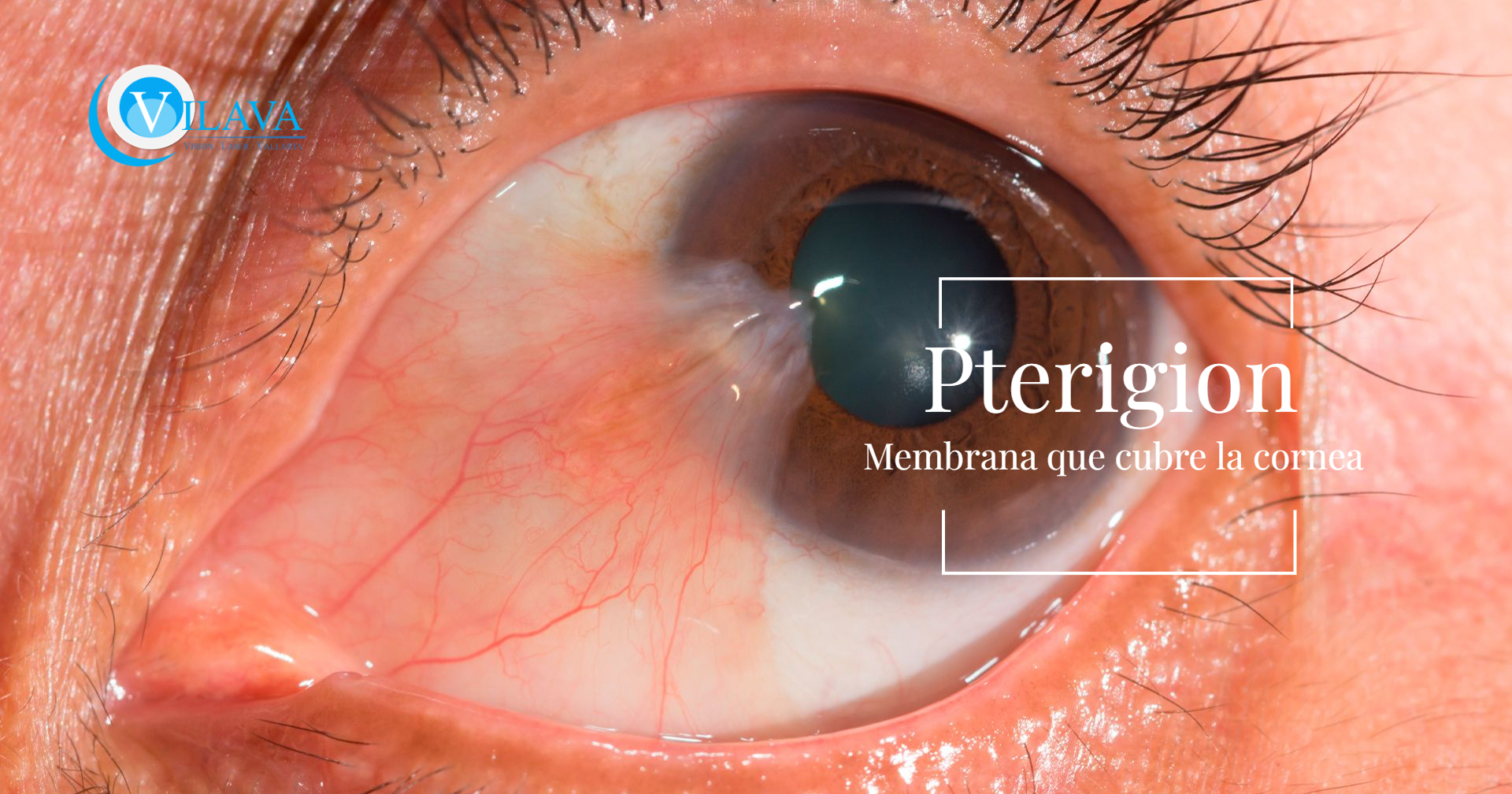 Untitled Design (14) Untitled Design (14)